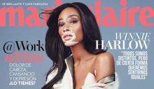 Winnie Harlow Chantelle Vitiligo Model Cover