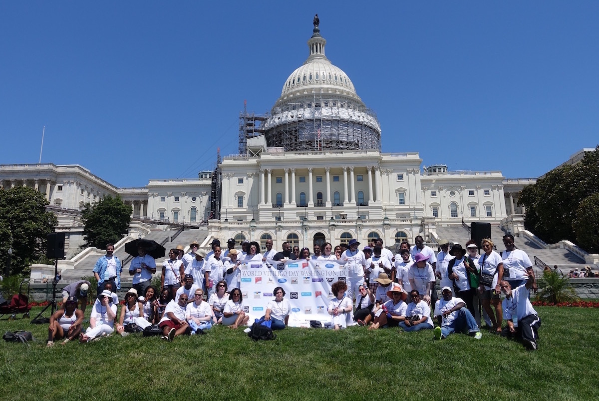 World_Vitiligo_Day_2016_Washington-0