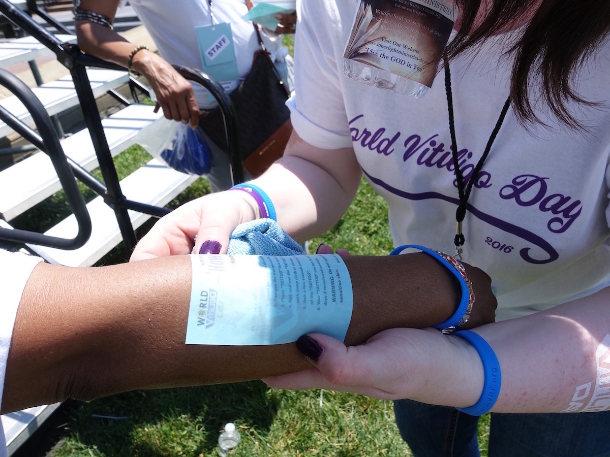 World_Vitiligo_Day_2016_Washington-2