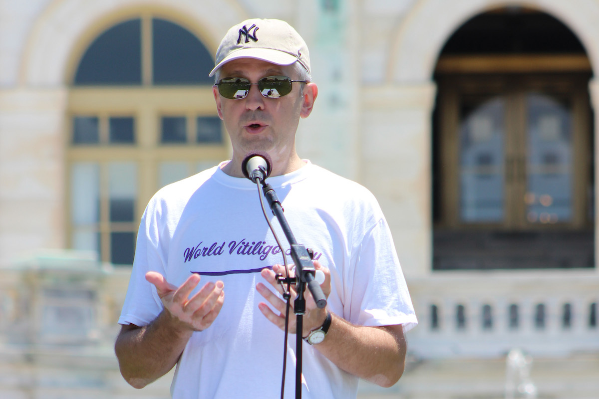 World_Vitiligo_Day_2016_Washington-Yan-Valle-5