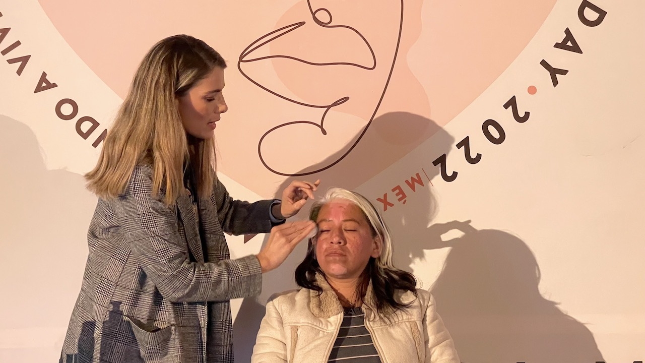 World Vitiligo Day 2022 Mexico