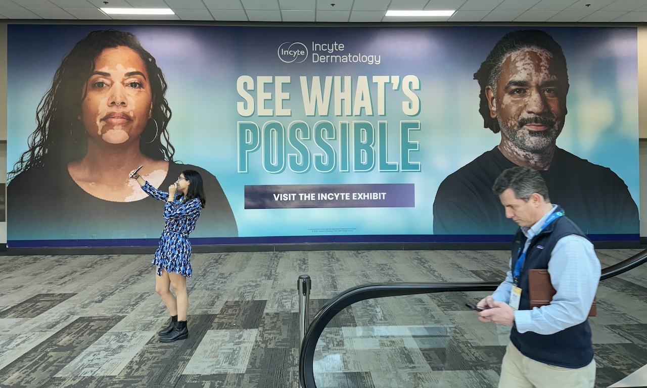 Vitiligo marketing