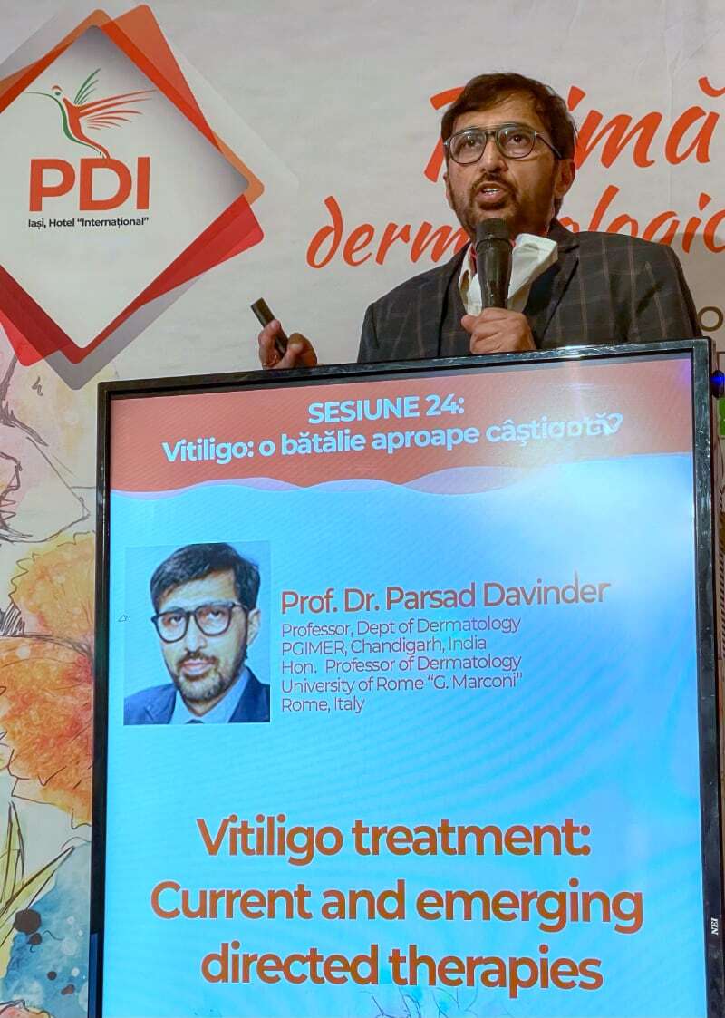 Prof. Davinder Parsad - vitiligo